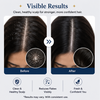 EvoraCare Anti Dandruff Shampoo.