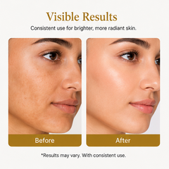EvoraCare Skin Brightening Face Serum, Lightweight & Fast-Absorbing Facial Serum for Even-Looking Skin Tone, Daily Skincare Serum for Radiant-Looking Skin, 30 ml