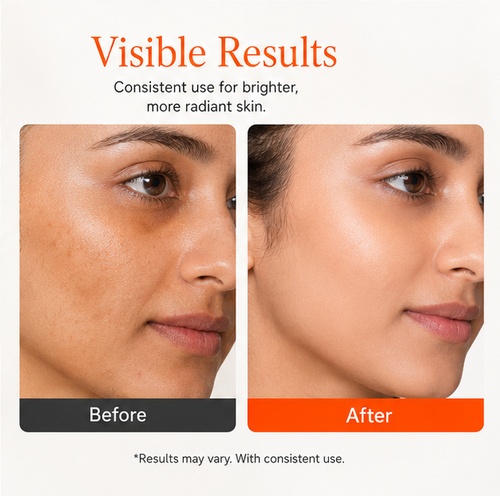 EvoraCare 10% Vitamin C Brightening Face Serum for Daily Skincare, Lightweight Facial Serum for Radiant-Looking Skin, Helps Improve Skin Appearance, 30 ml