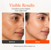 EvoraCare 10% Vitamin C Brightening Serum.