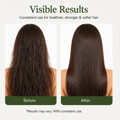 EvoraCare Rosemary Conditioner for Dry, Weak & Frizzy Hair, Nourishing Hair Conditioner with Rosemary Extract, Smooth & Manageable Hair Care, 200 ml