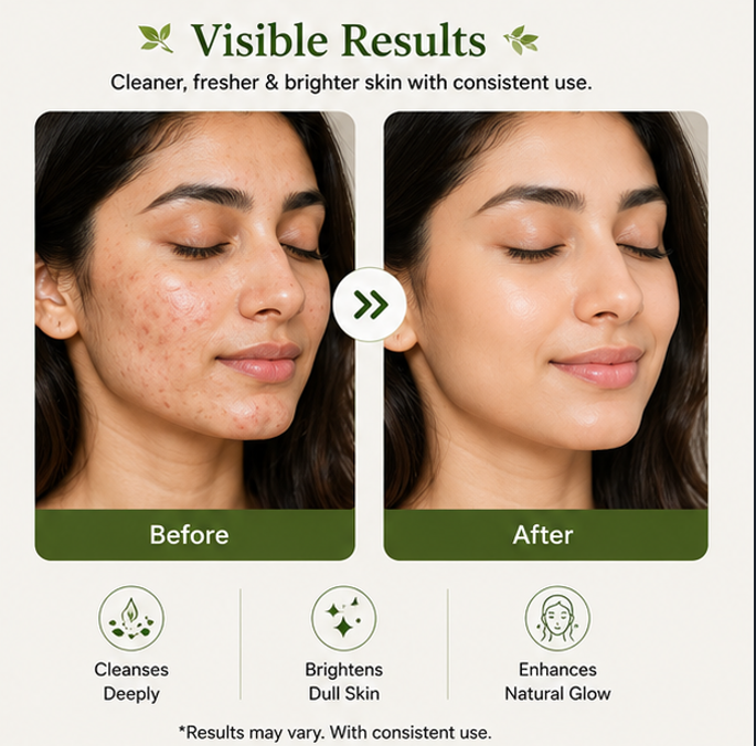EvoraCare Green Tea Face Wash with Built-In Silicone Brush, Daily Facial Cleanser for Fresh & Clean Skin, Gentle Face Wash for Men & Women, 150 ml
