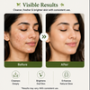 EvoraCare Green Tea Face Wash.