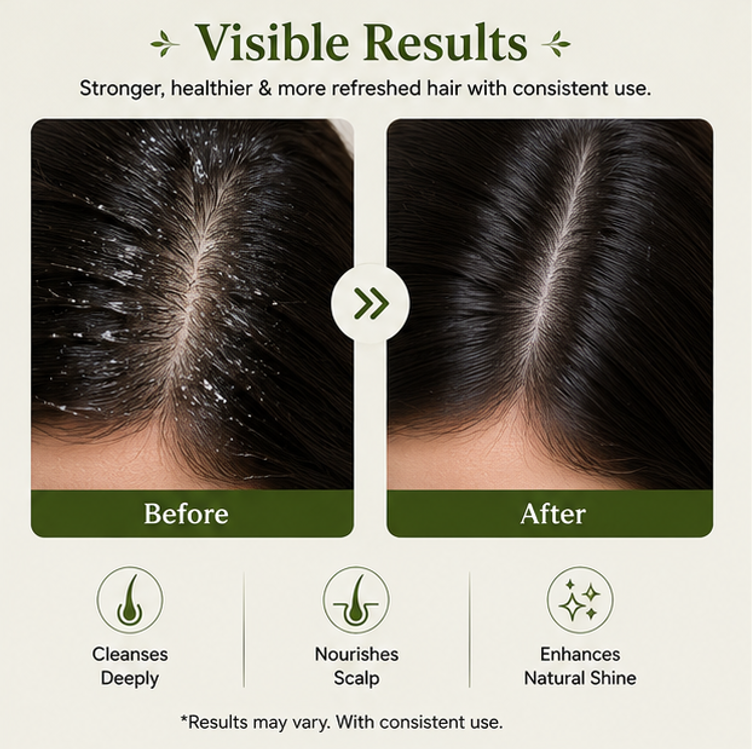 EvoraCare Rosemary Shampoo for Daily Scalp & Hair Care, Gentle Cleansing Shampoo with Rosemary-Inspired Formula, Refreshing Hair Cleanser for Men & Women, 200 ml