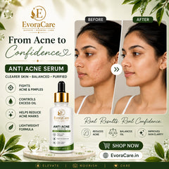 EvoraCare 15% Anti Acne Face Serum.