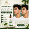 EvoraCare 15% Anti Acne Face Serum.