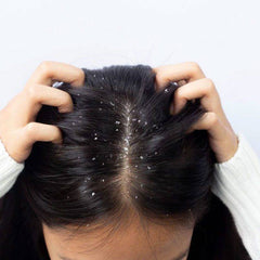 Anti Dandruff